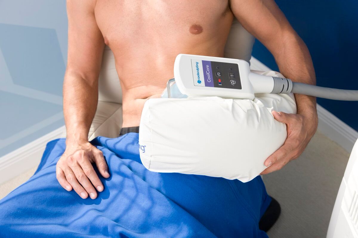 Procedure of Coolsculpting