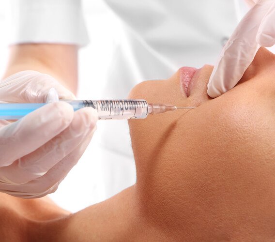 Procedure of Dermal Fillers