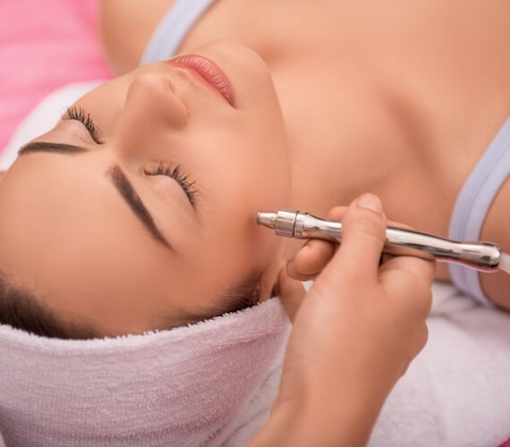 Procedure of Pelleve skin tightening